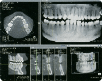 三次元の高画質画像1