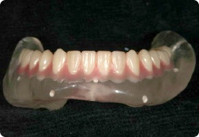 ラジオグラフィックガイド作製